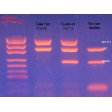 Neo-Gene_GSTT1/GSTM1 ins/del