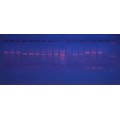 Генотипування головного комплексу гістосумісності генів II класу HLA-DQA1  методом полімеразної ланцюгової реакції
