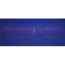 Генотипування головного комплексу гістосумісності генів II класу HLA-DQA1  методом полімеразної ланцюгової реакції